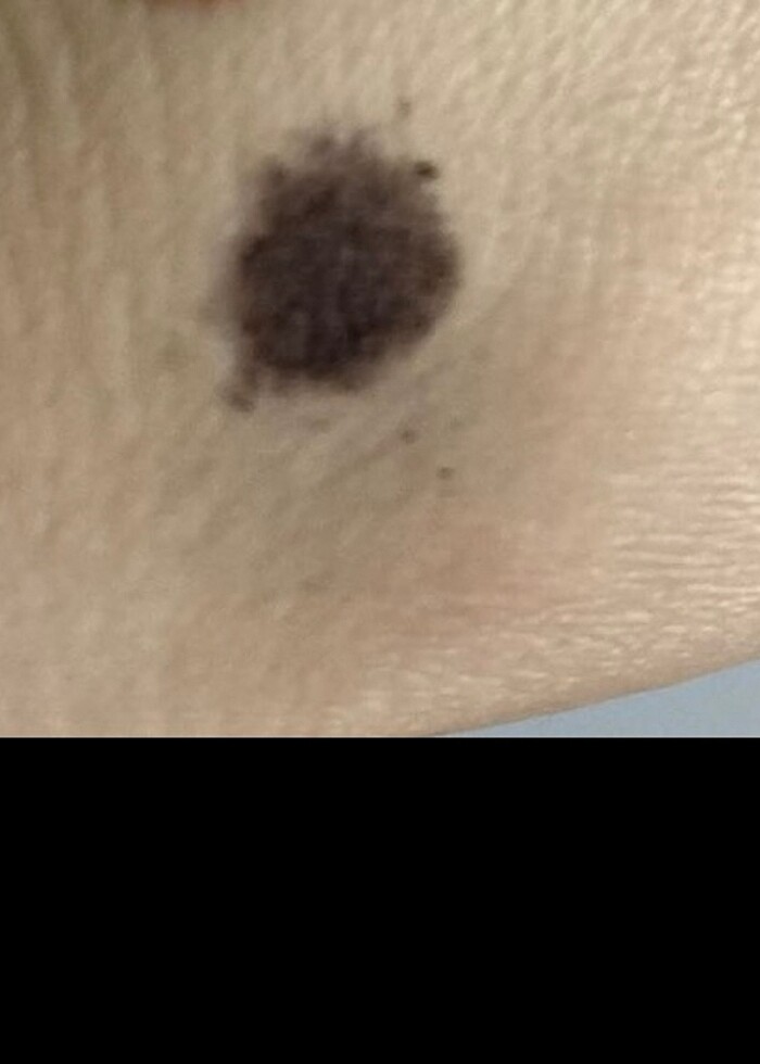 Kaş pudrası - Görsel 3