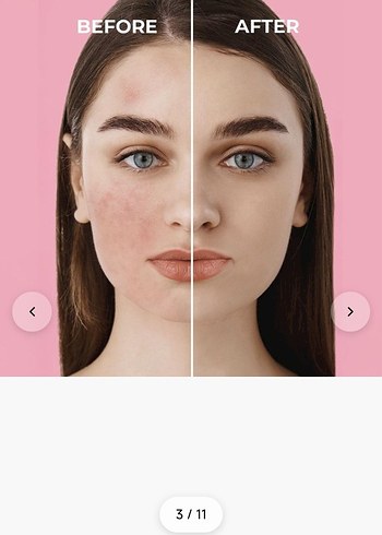 sinoz SPF 50 BB etkili Güneş Koruyucu - Görsel 2