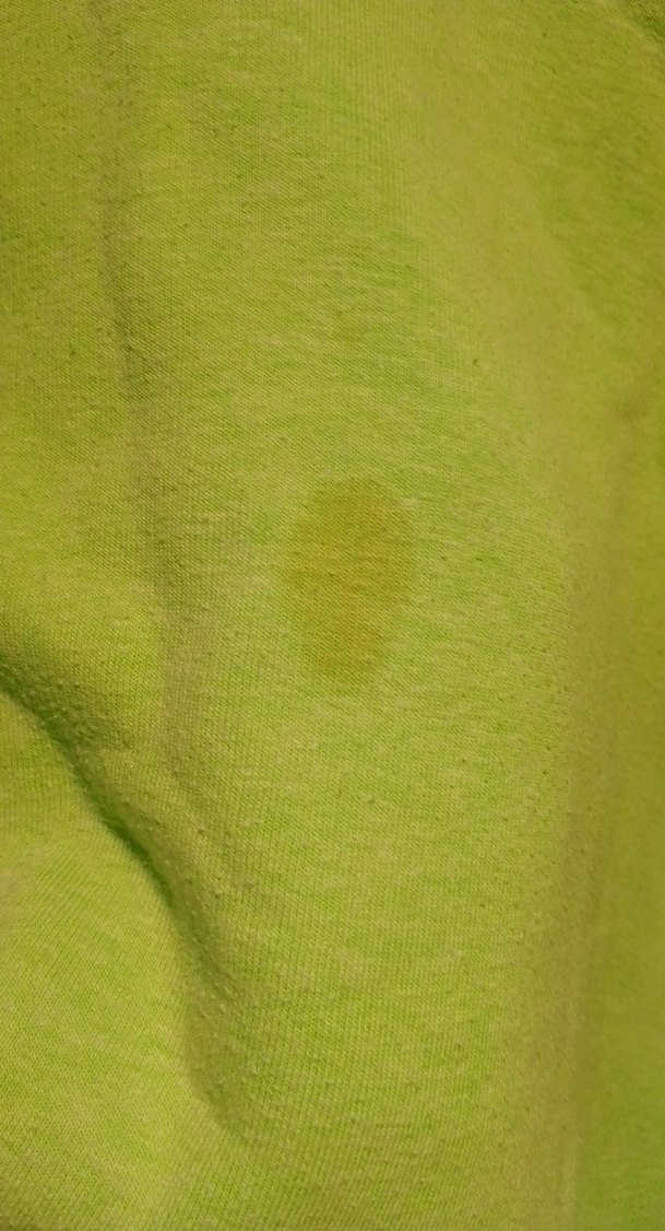 Kadın Yeşil Kapüşonlu - Görsel 2