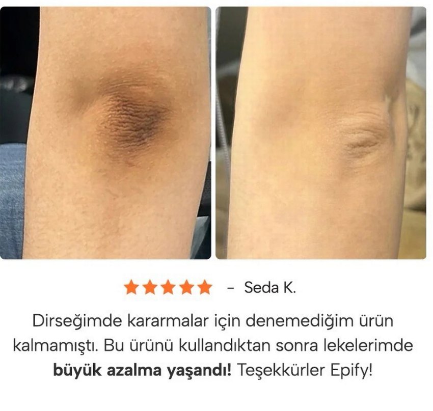Epify Glutathione Shot Cilt Aydınlatıcı Peeling - Görsel 3