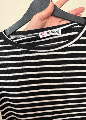 Kadın Siyah Çizgili kısa Elbise - Görsel 3