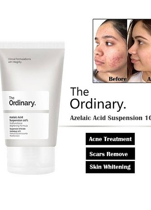 The Ordinary