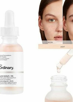 The ordinary