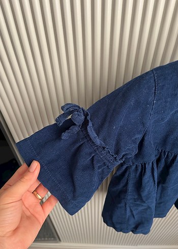 Düğmeli kız çocuk kadife elbise - Görsel 2