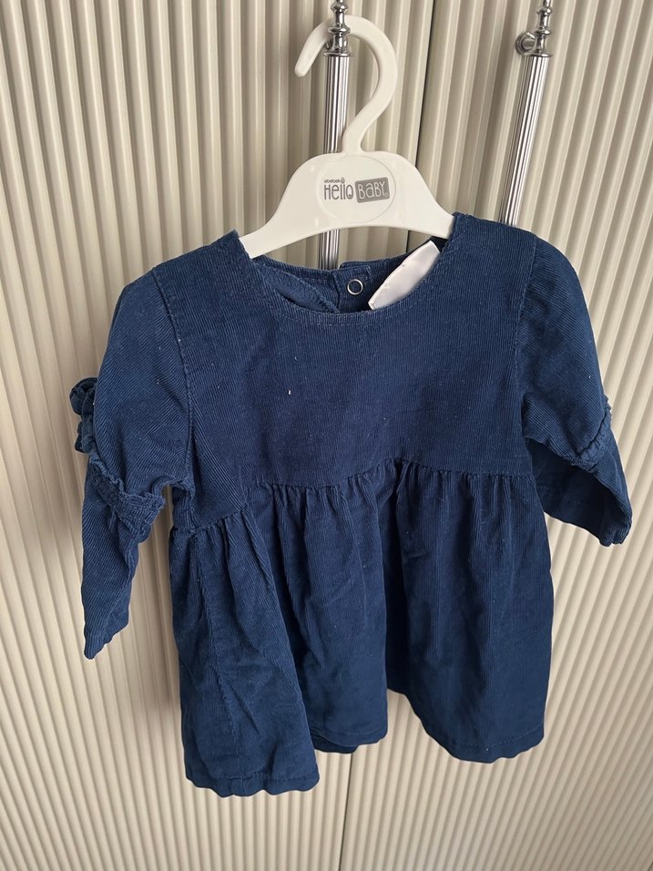 Düğmeli kız çocuk kadife elbise - Görsel 3