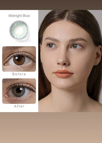 freshgo lens