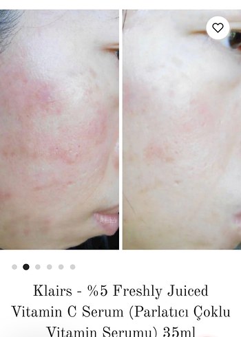 Klairs %5 Freshly Juiced Vitamin C serum
