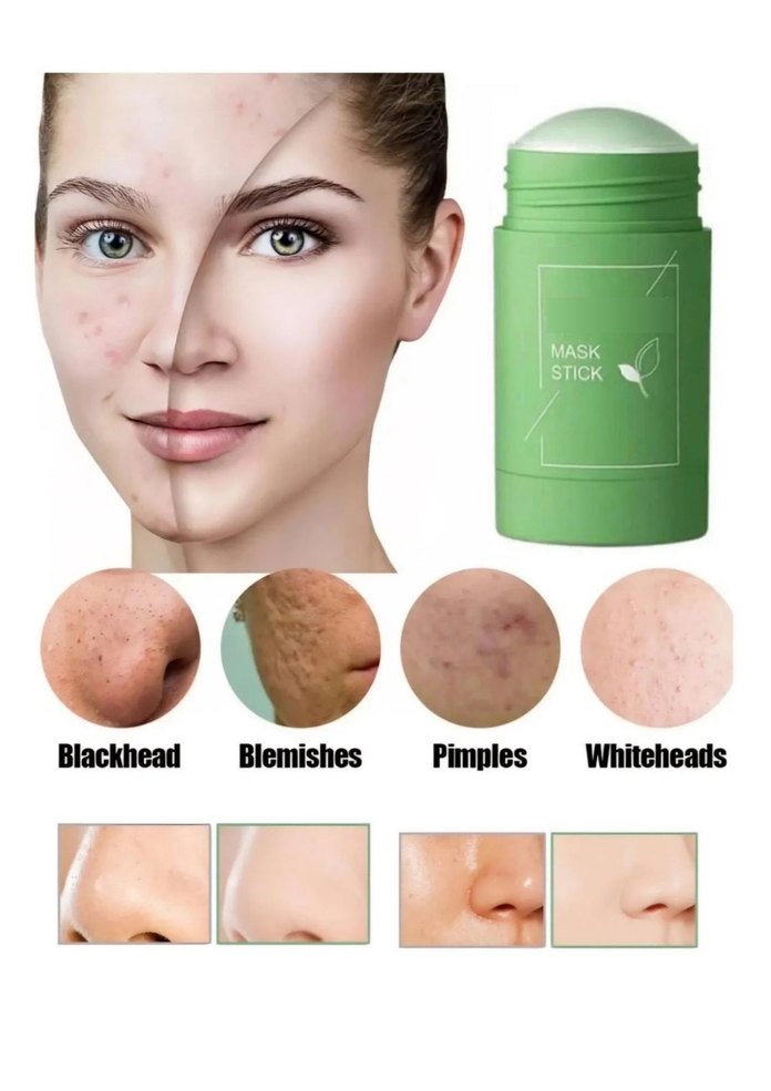 Yeşil Çay Özlü Siyah Nokta Maskesi - Green Mask %100 Natural - Görsel 2