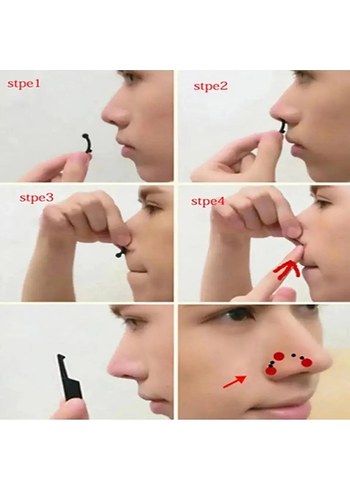 6'lı Burun Kaldırma Aparatı - Görsel 3