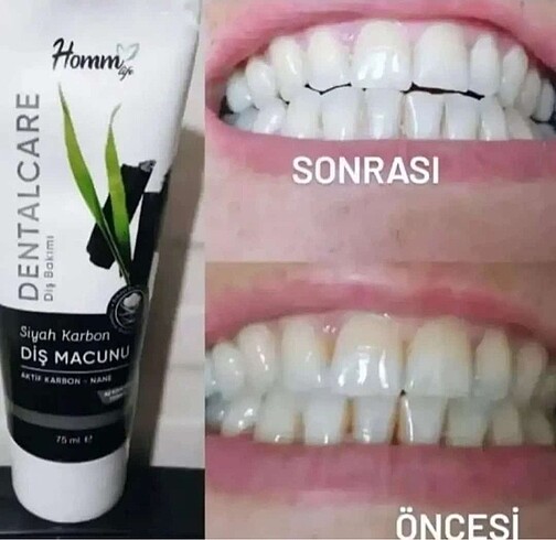  Beden Renk Diş macunu