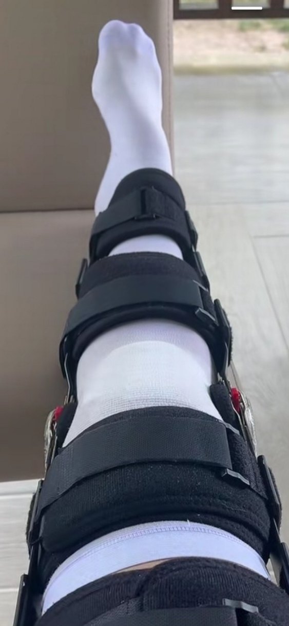 yeni ayarlanır dizlik - Görsel 4