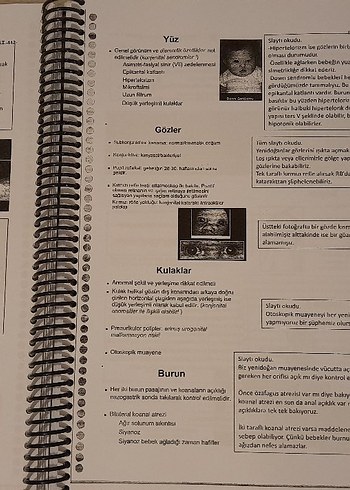 Pediatri - 3 cilt Hacettepe tıp dönem 4 notları, Türkçe - Görsel 4