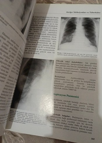Solunum Sistemi Radyolojisi Kitabı - Görsel 2