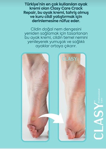 CLASY Ayak ve Topuk Kremi - Yenilenmiş - Görsel 8