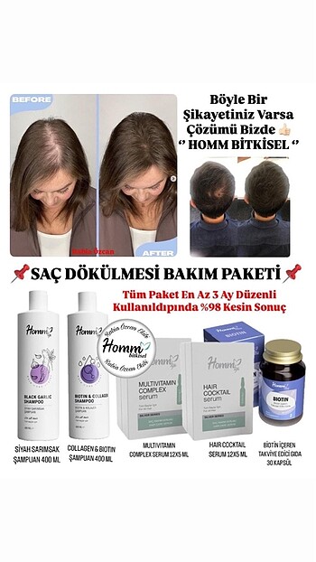 Homm Bitkisel Biotin İçeren Takviye Edici Gıda - Görsel 5