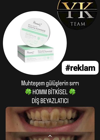 Hommy Beyazlatıcı Diş Tozu - Görsel 3