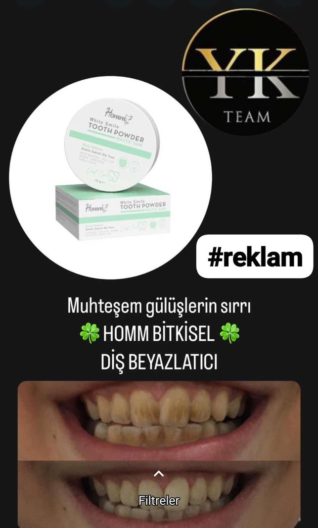 Hommy Beyazlatıcı Diş Tozu - Görsel 3