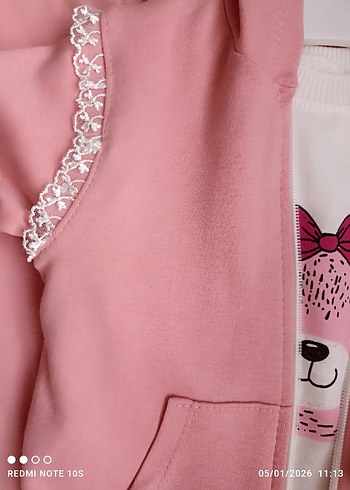 Pembe Kız Bebek Kapüşonlu Takım - Görsel 7
