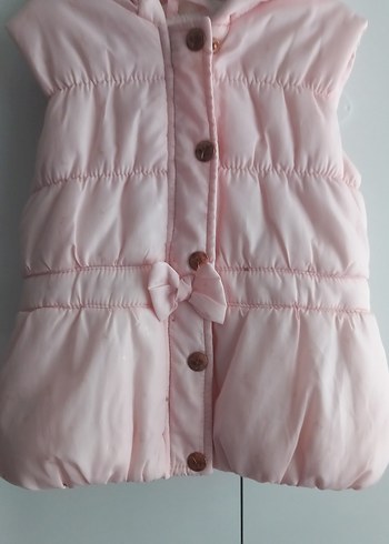 Düğmeli Pembe Kız Çocuk Yeleği - Görsel 2