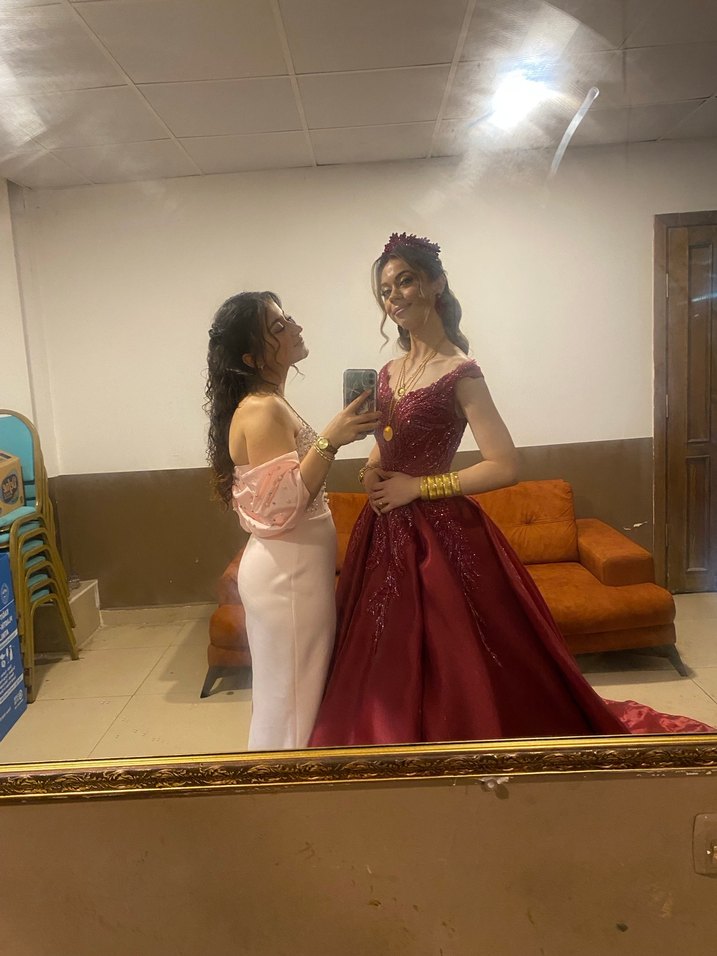 Pembe balon kol elbise - Görsel 2