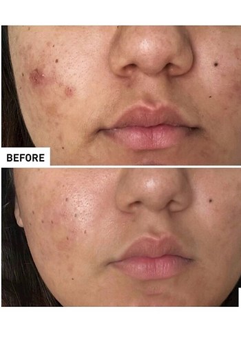 Erborian Centella Acné Care 30 ml - Görsel 3