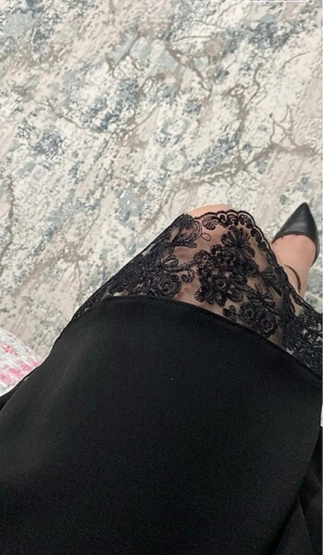 Siyah dantel detaylı elbise - Görsel 2