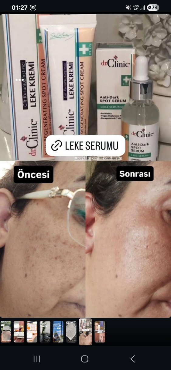 Dr.Clinic Leke Serumu 30 ml - Görsel 2