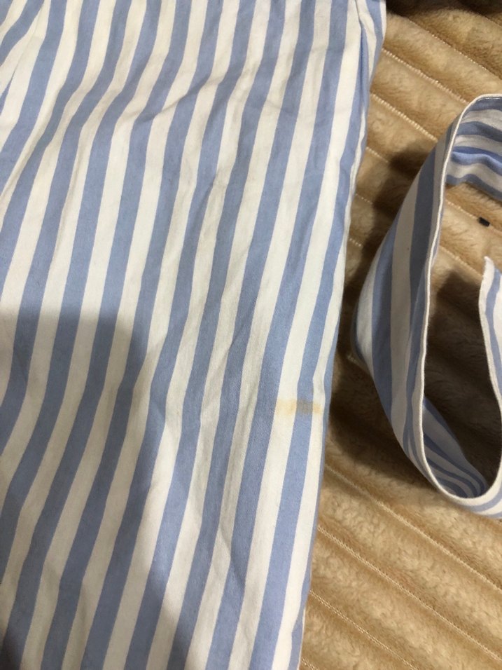 Düğmeli Çizgili Elbise - Görsel 3