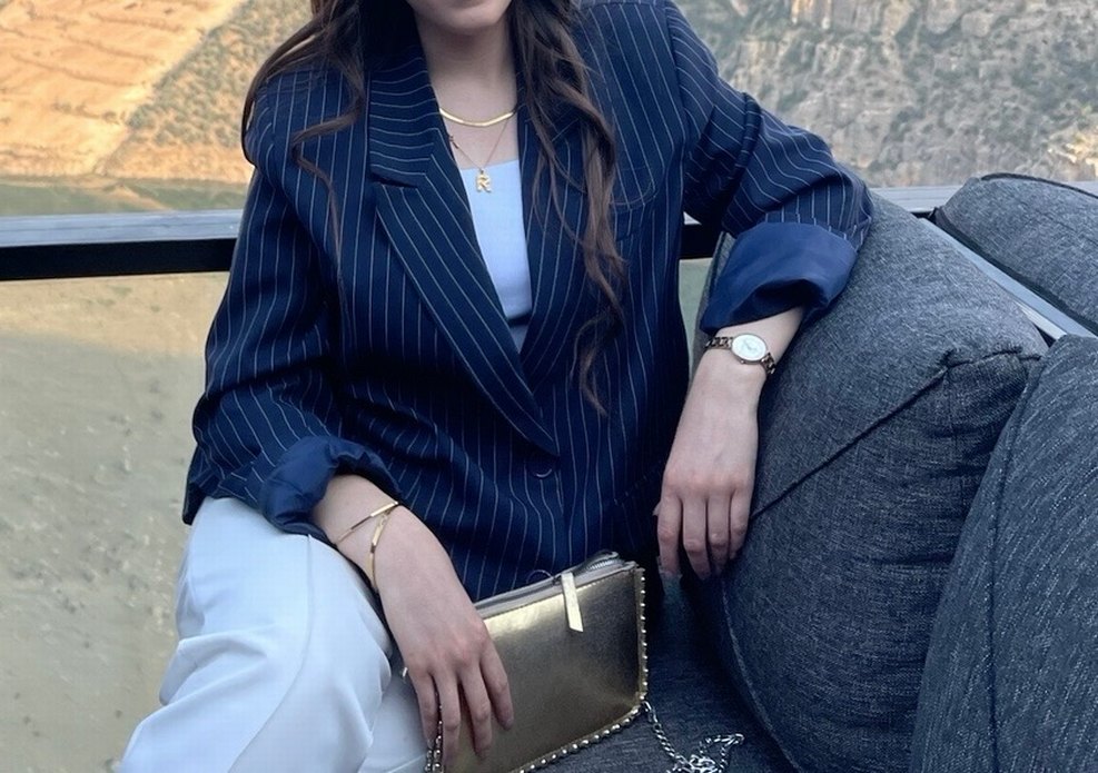 Kadın Çizgili Regular Fit Blazer - Görsel 2