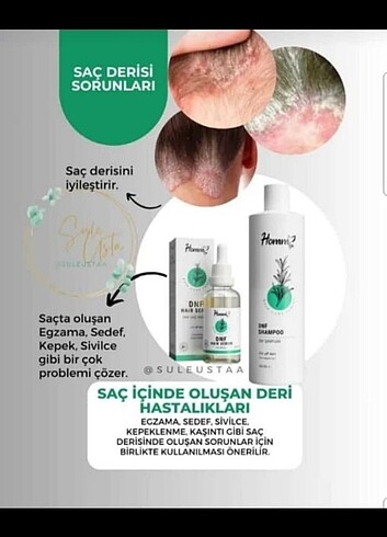 Egzama için birebir
