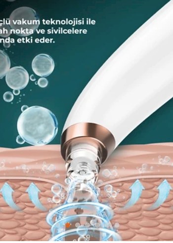 Su Hazneli Siyah Nokta Temizleme Aleti - Görsel 6