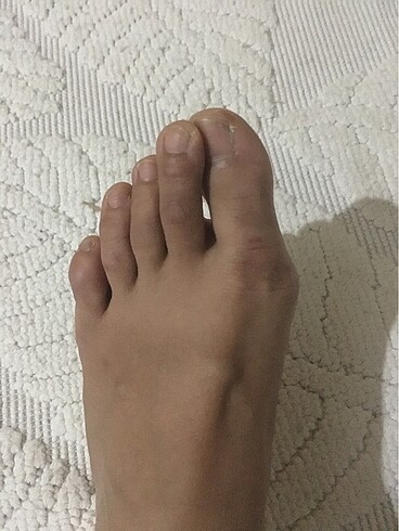 kalın kısa topuklu ipli sandalet - Görsel 6