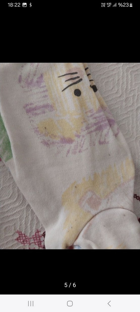 Bebek Kız Baskılı Dantelli 4'lü Takım - Görsel 3