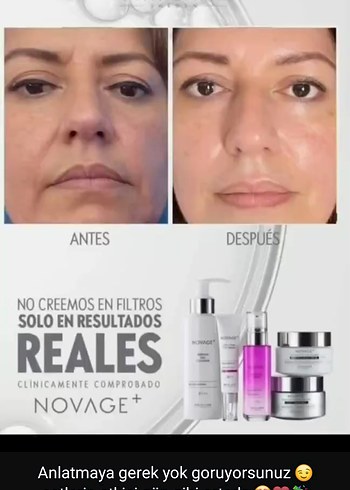 Novage 5 Parça Cilt Bakım Seti - 2700 TL - Görsel 2