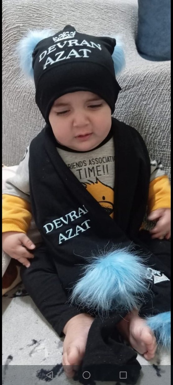 Kız Çocuk Kürklü Baskılı Pembe Bere ve Atkı Seti - Görsel 2