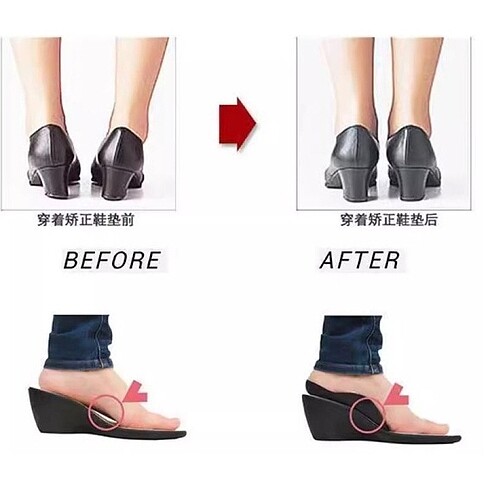 Esnek Düz Taban Düzeltici Topuk Yastığı - Görsel 3