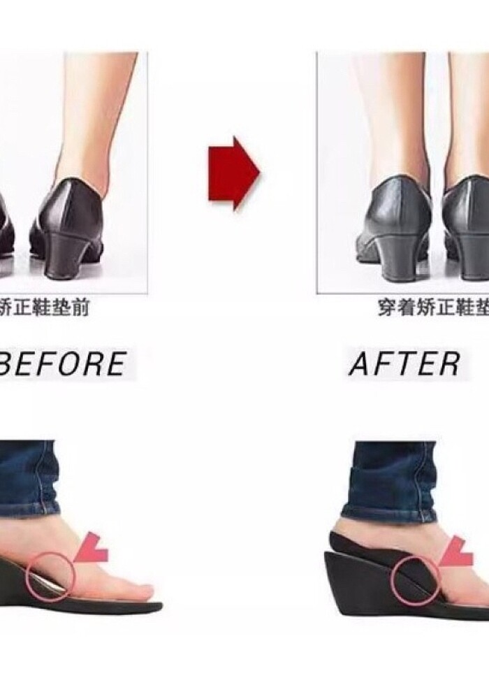 Esnek Düz Taban Düzeltici Topuk Yastığı - Görsel 3