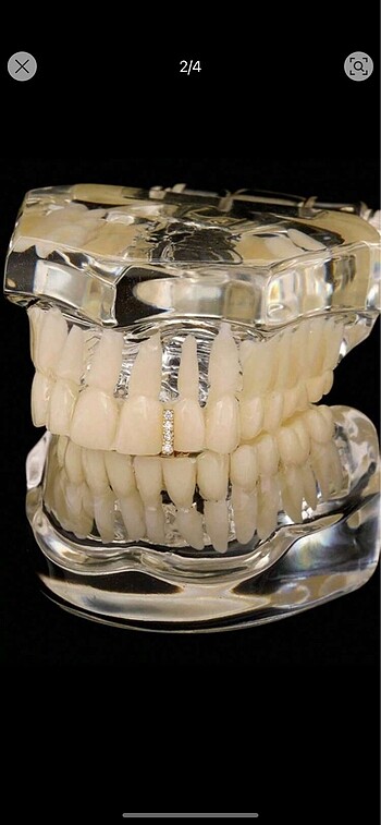Line grillz