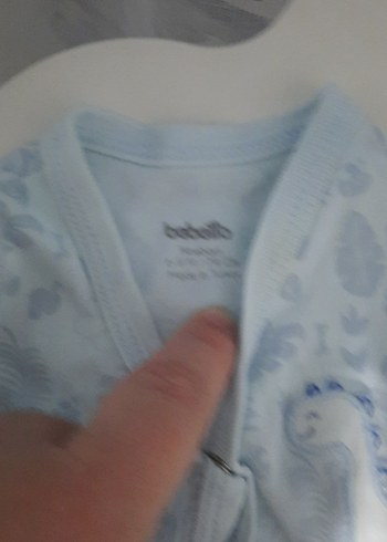 Erkek Bebek Renkli Düğmeli Kolsuz Hastane Tulumu - Görsel 4