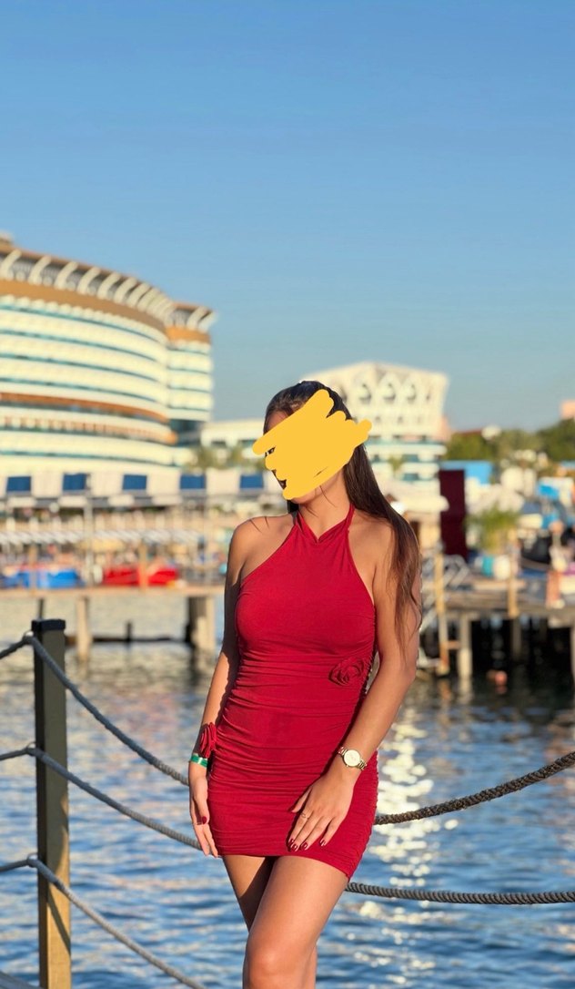 Kırmızı Mini Elbise - Görsel 2