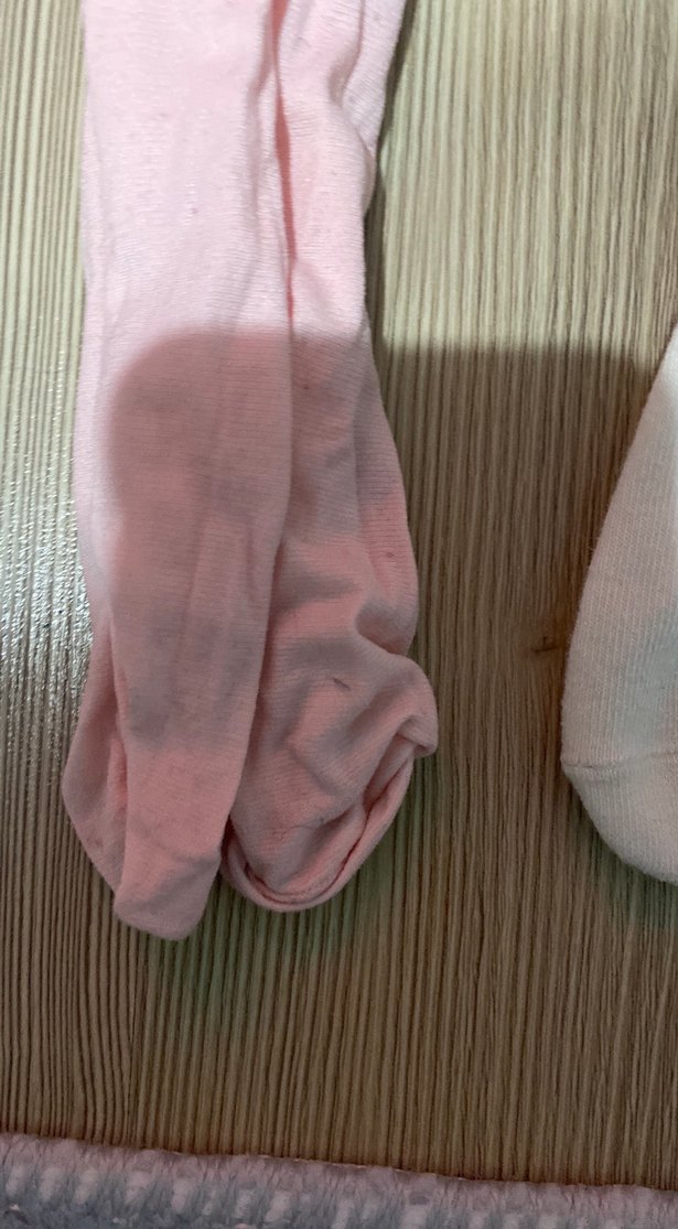 Kilotlu çorap kız - Görsel 5