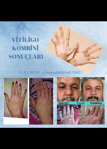 Doğal Diş Beyazlatma Tozu - Khaki - Görsel 2