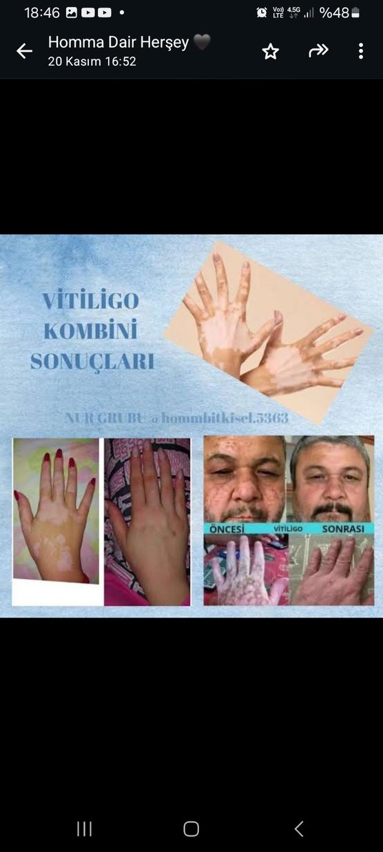 Doğal Diş Beyazlatma Tozu - Khaki - Görsel 2