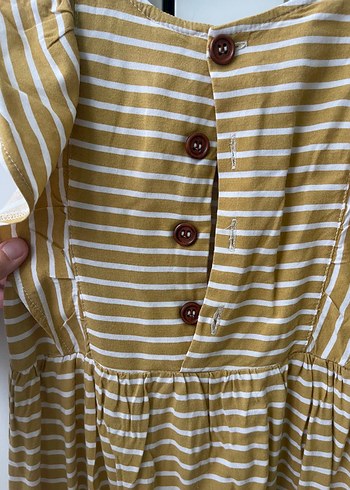 Çizgili Sarı Kız Çocuk Elbise - Görsel 4