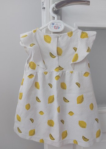 Zara Kız Çocuk Sarı Desenli Elbise