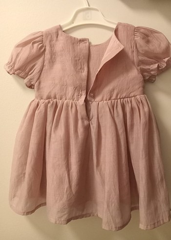 Pembe dogum gunu Kız Elbisesi - Görsel 5