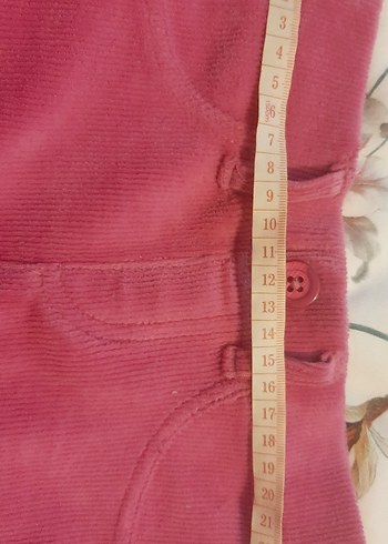 Düğmeli Pembe Kız Çocuk Etek - Görsel 5