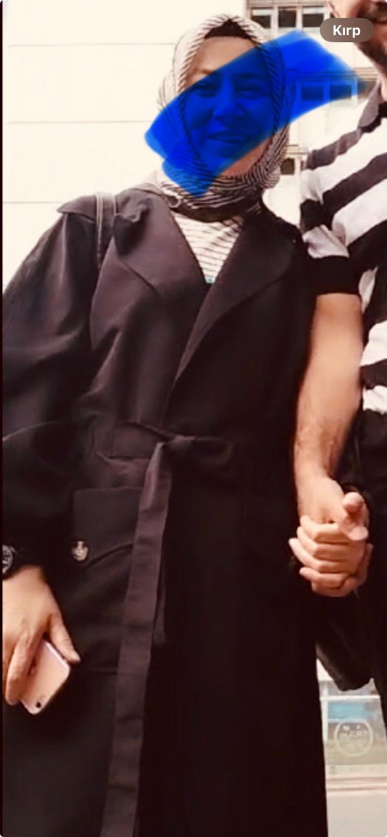 Düğmeli Siyah trençkot - Görsel 2