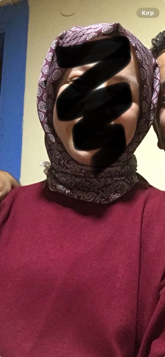 Bordo Kadın Salaş Elbise - Görsel 4