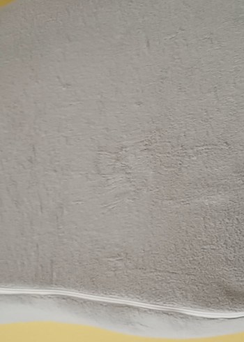 Reflü yatağı - Görsel 7